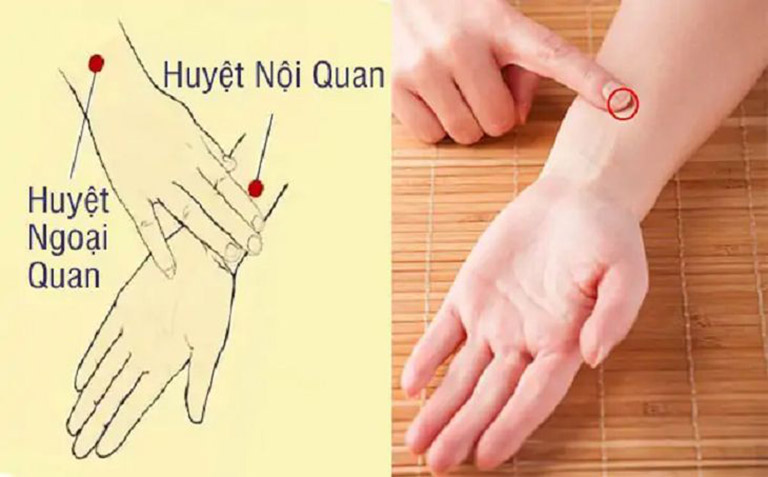 Cách bấm huyệt chữa mất ngủ