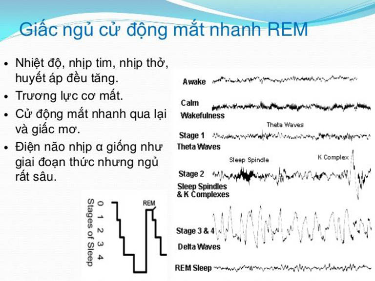 Hiện tượng bóng đè khi ngủ