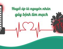 Suy nhược thần kinh ảnh hưởng đến tim mạch, huyết áp?