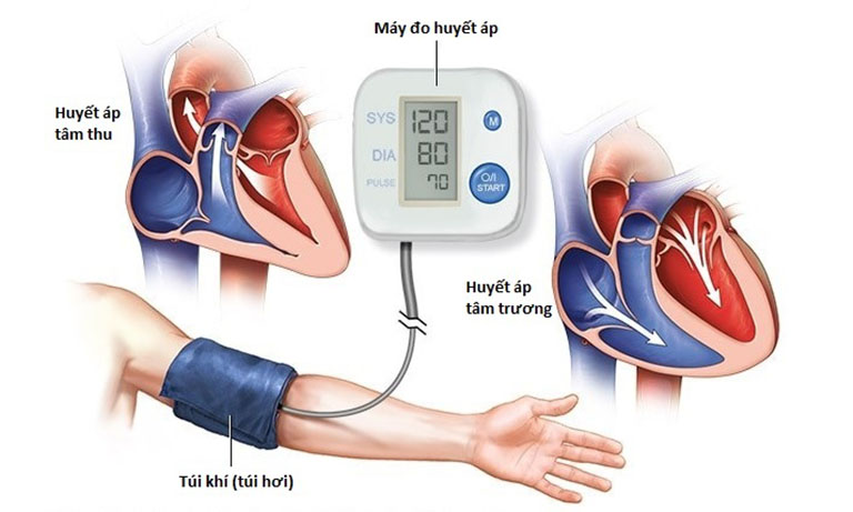 Suy nhược thần kinh ảnh hưởng đến tim mạch, huyết áp?