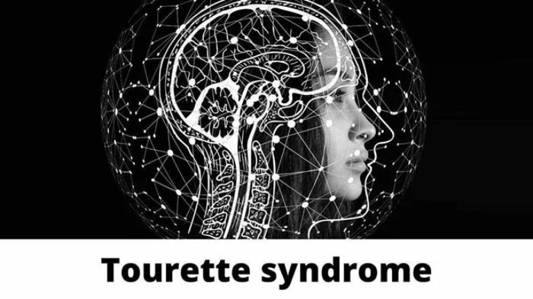 Hội chứng Tourette